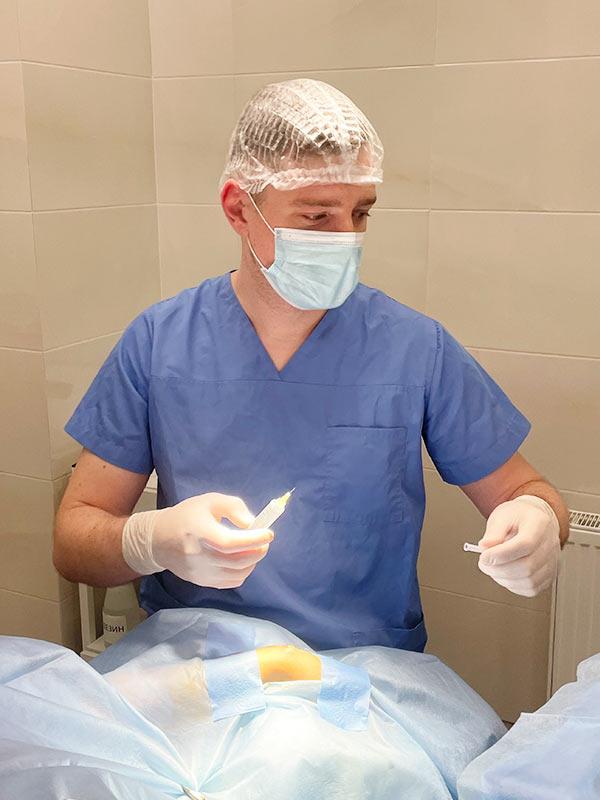 Видалення аспірація гігроми кісті Київ