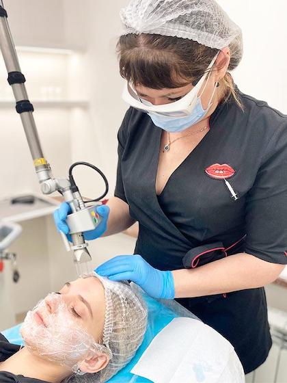 Лазерний пілінг обличчя Київ