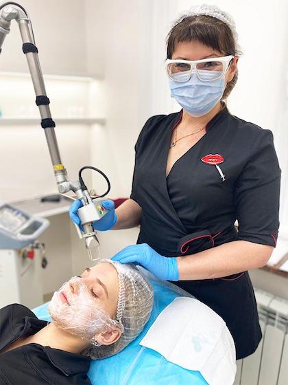 Лазерне лікування постакне Київ