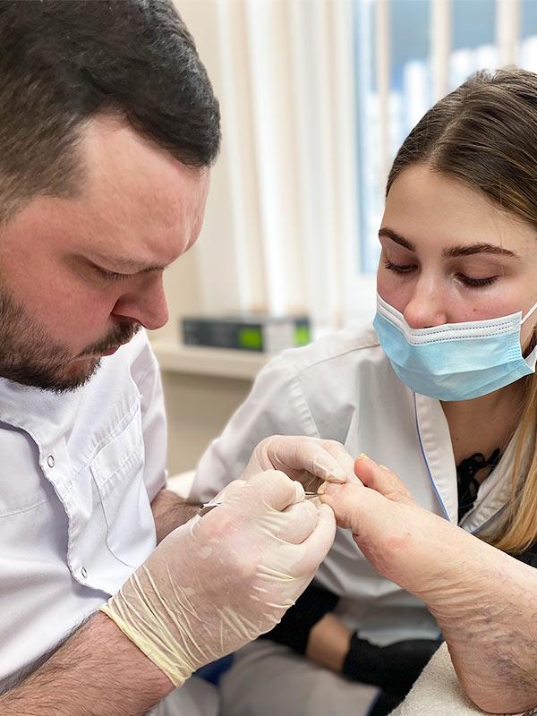 Лікування врослого нігтя – титанова нитка, скоби