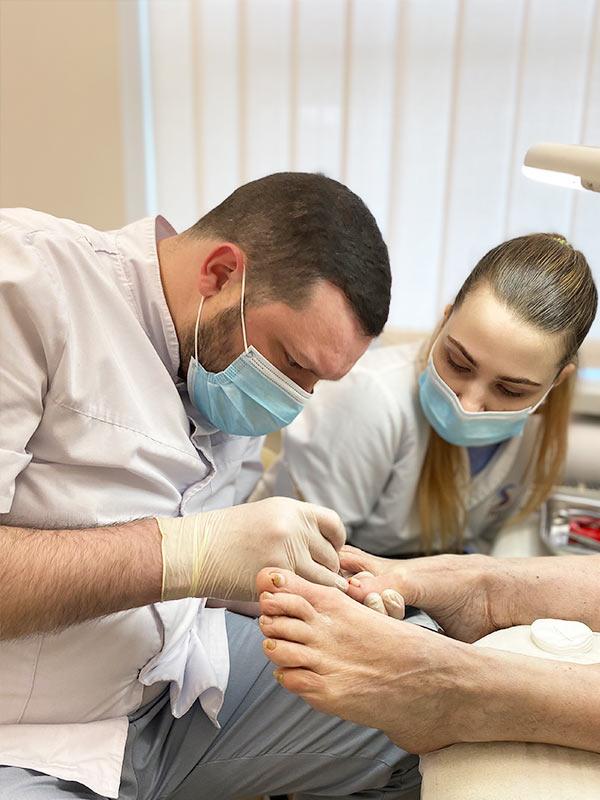 Лікування врослого нігтя – подолог Київ