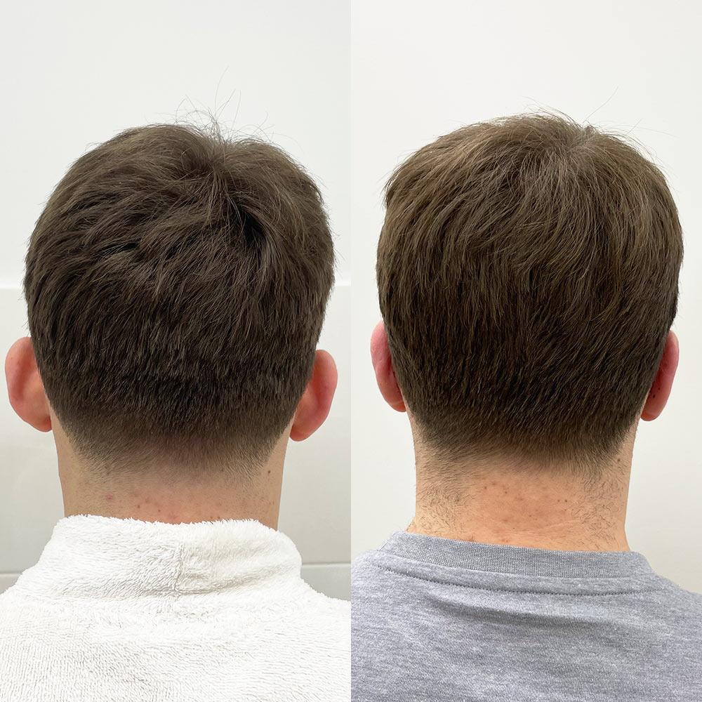 Отопластика Киев