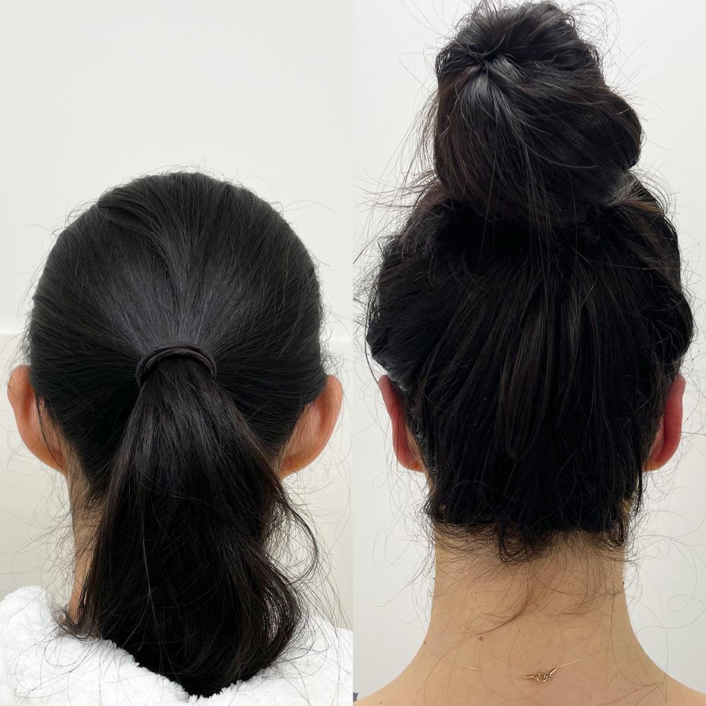 Отопластика Київ