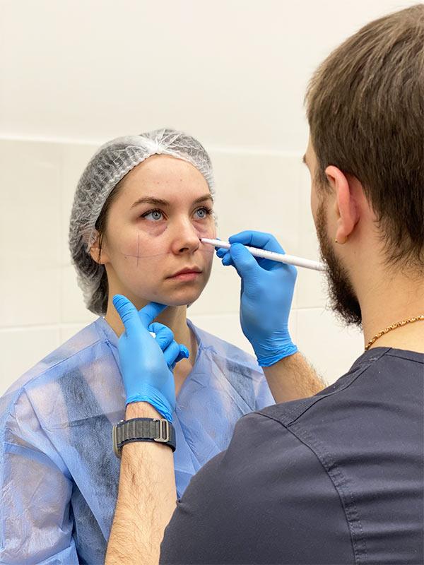 Консультація пластичного хірурга Київ