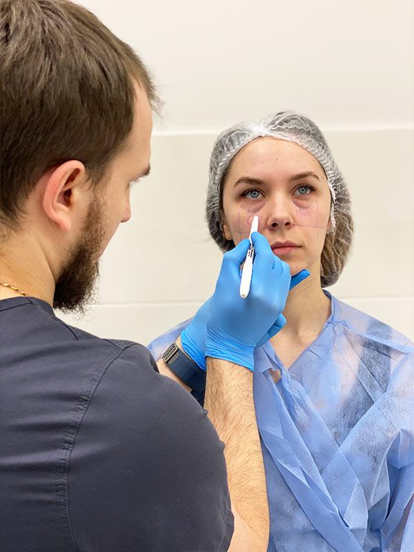 Консультація пластичного хірурга Київ