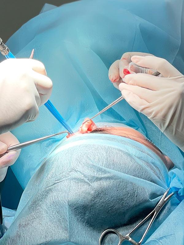 Отопластика – корекція вушних раковин Київ