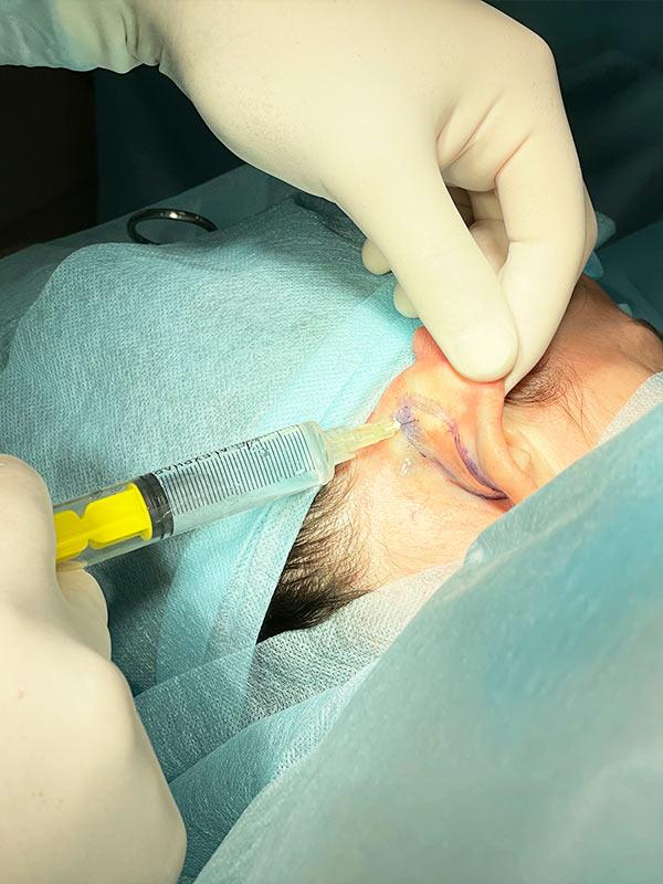 Отопластика Київ