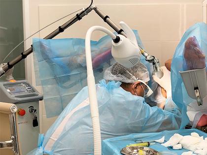 Лазерне лікування вагінальної атрофії Київ