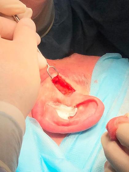 Mosh хірургія Київ