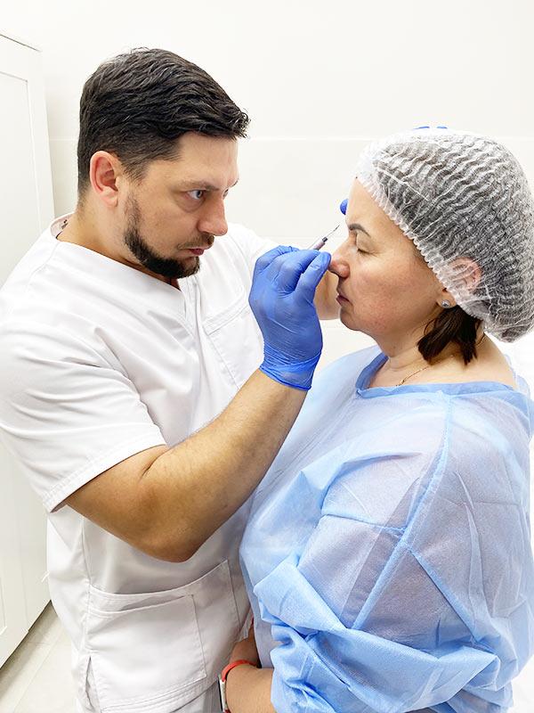 Блефаропластика век Киев