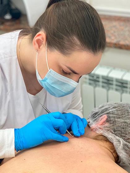 Комбінована чистка спини Київ