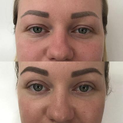 Пластика повік Київ