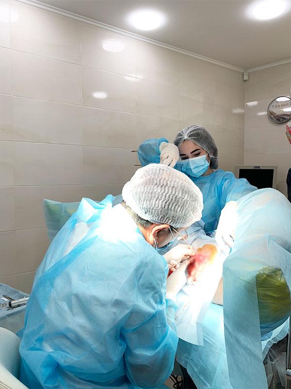 Лабіопластика в Києві — корекція малих статевих губ