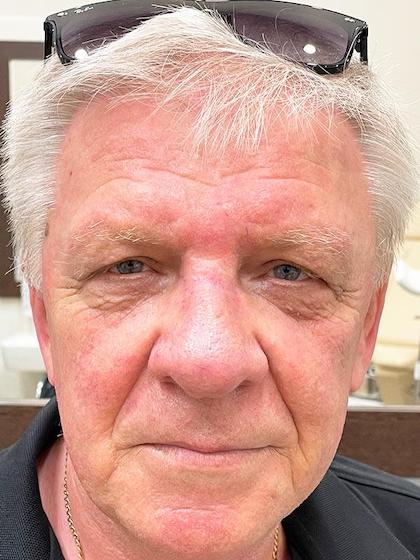 Mosh хирургия Киев Mosh хирургия Киев