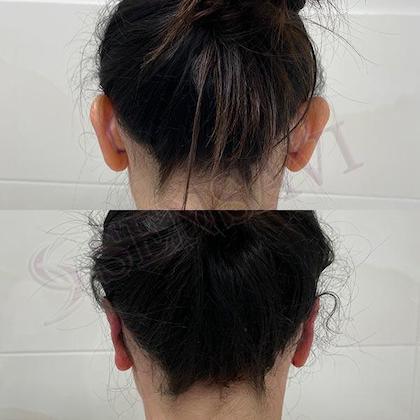 Отопластика Київ