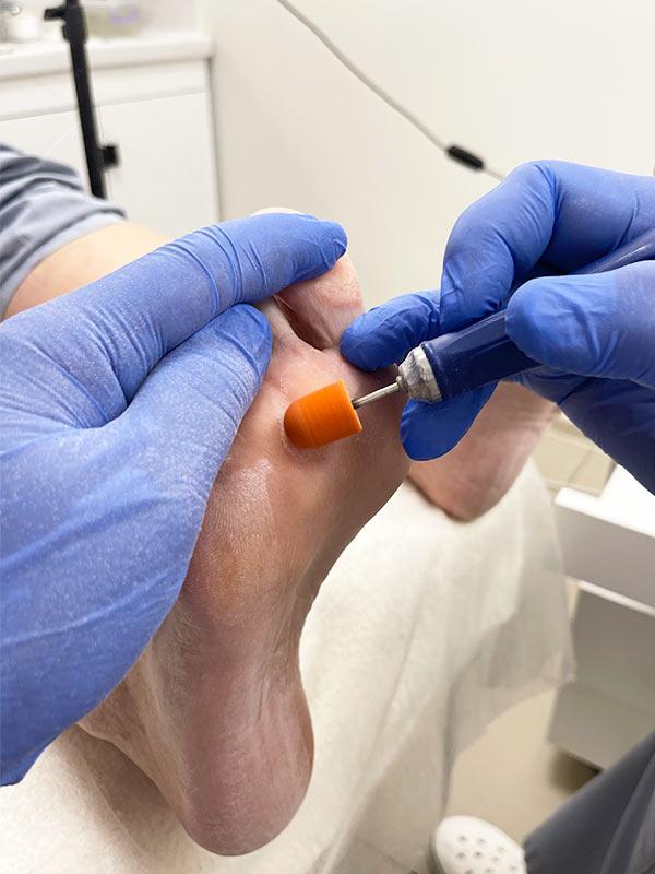 Подолог Киев – Медицинский педикюр Подолог Киев – Медицинский педикюр