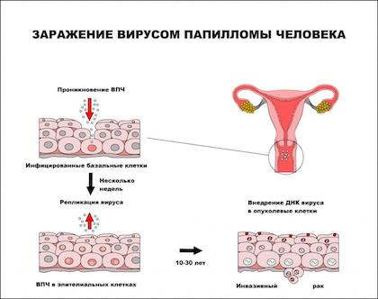 Вирус папилломы человека