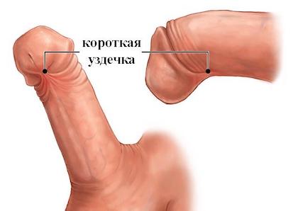Пластика вуздечки Київ