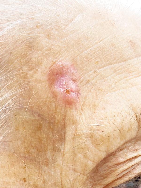 Базалиома Киев Базалиома Киев