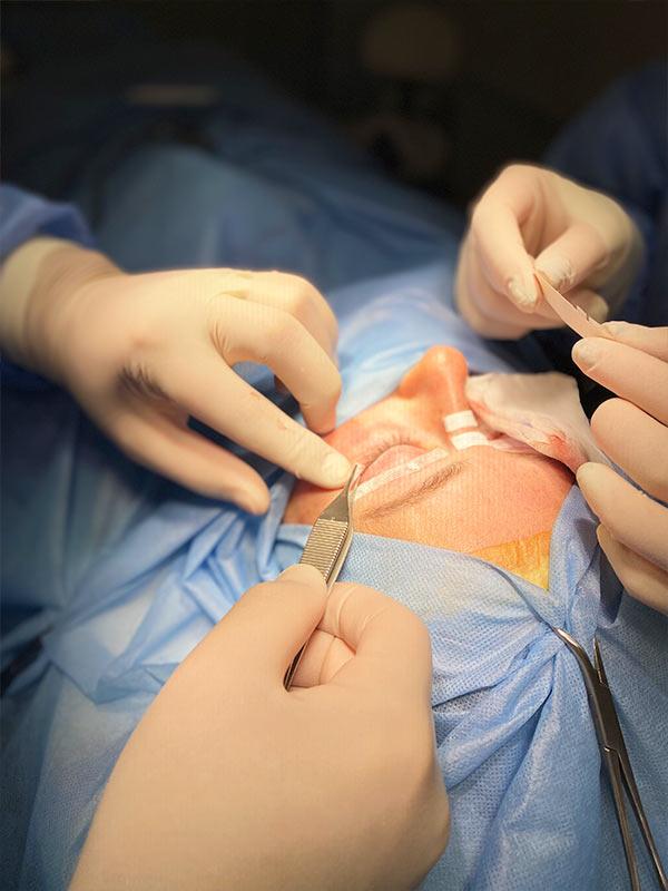 Блефаропластика – подтяжка век Киев