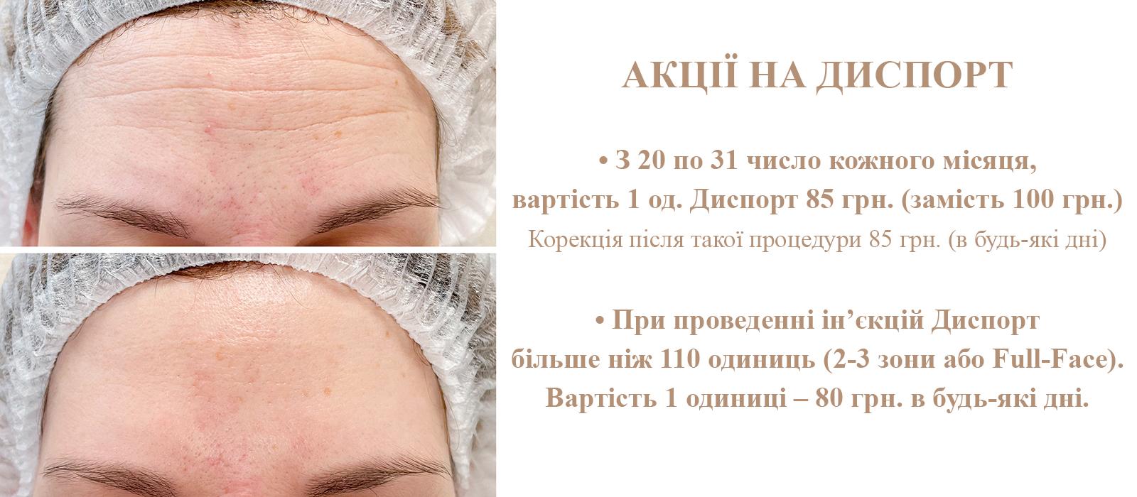 Скидка 14% на Диспорт